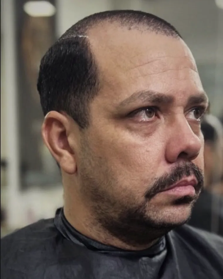 Cliente do Studio Wolver antes da aplicação da prótese capilar