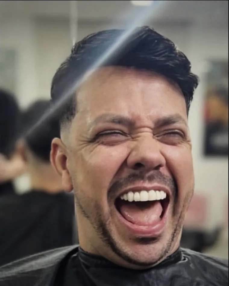 O mesmo cliente depois da aplicação da prótese capilar, com corte e acabamento